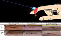 درمان جراحات حیوانات با طول‌موج 800 نانومتر صورت می‌گیرد