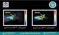 مسیر دارو رسانی به مغز ردیابی شد