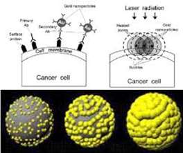 حذف 100 درصدی سلول‌های سرطان با تابش لیزر روی نانوذرات