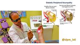 نوروپاتی دیابتی با لیزر