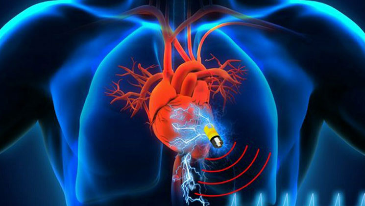 فناوری‌های همگرا | ضربان‌سازهای ایران‌ساخت به کاهش نارسایی‌های قلب کمک می‌کند  